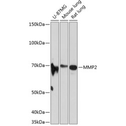 MMP2 Rabbit mAb