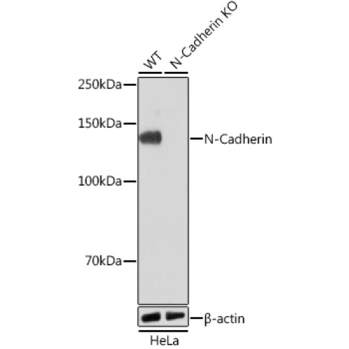 [KO Validated] N-Cadherin Rabbit mAb