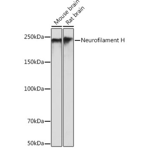 Neurofilament H Rabbit mAb