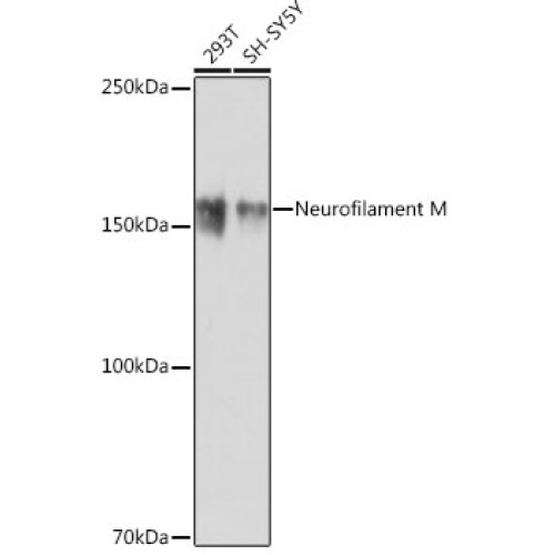 Neurofilament M Rabbit mAb
