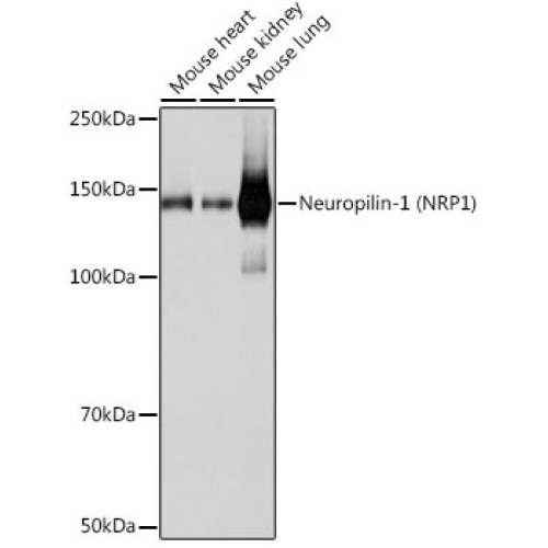 Neuropilin-1 (NRP1) Rabbit mAb