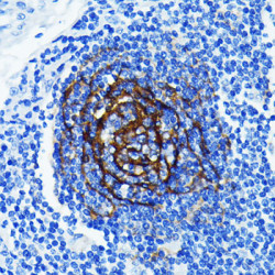 p75NTR/NGFR Rabbit mAb