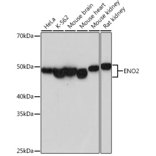 ENO2 Rabbit mAb