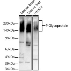 [KO Validated] P Glycoprotein Rabbit mAb