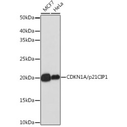[KO Validated] CDKN1A/p21 Rabbit mAb