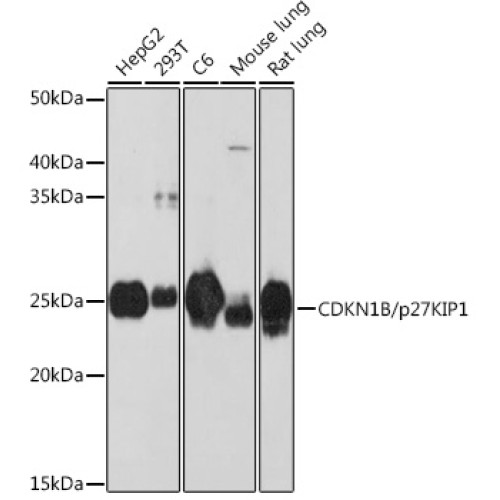 [KO Validated] CDKN1B/p27KIP1 Rabbit mAb