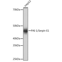 PAI-1/Serpin E1 Rabbit mAb