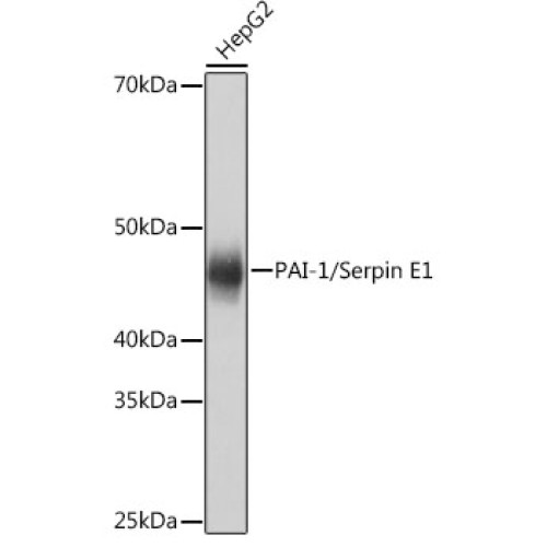 PAI-1/Serpin E1 Rabbit mAb