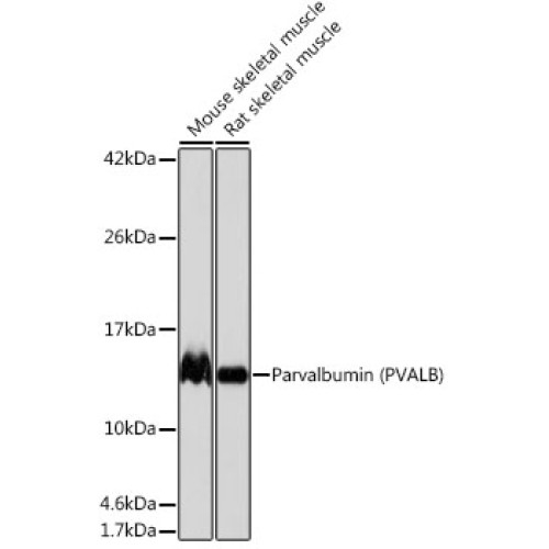 Parvalbumin/PVALB Rabbit mAb