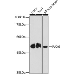 PAX6 Rabbit mAb