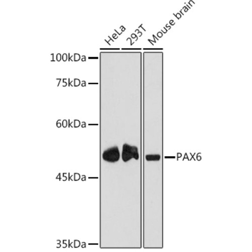 PAX6 Rabbit mAb