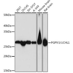 PGP9.5/UCHL1 Rabbit mAb