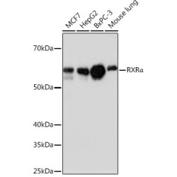 RXRα Rabbit mAb