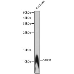 S100B Rabbit mAb