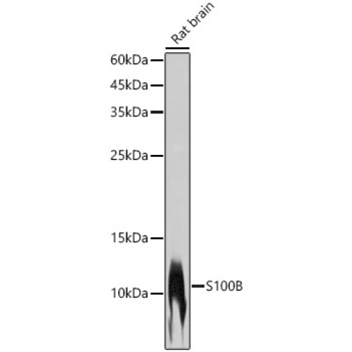 S100B Rabbit mAb