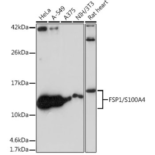 FSP1/S100A4 Rabbit mAb