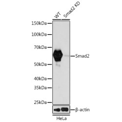 [KD Validated] Smad2 Rabbit mAb