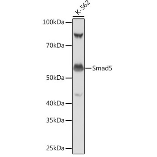 Smad5 Rabbit mAb