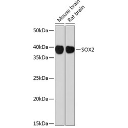 SOX2 Rabbit mAb