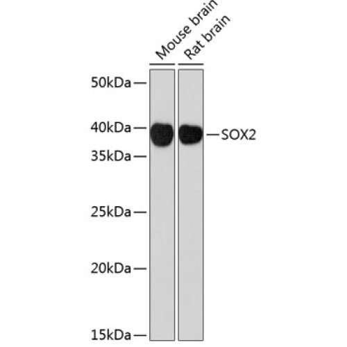 SOX2 Rabbit mAb