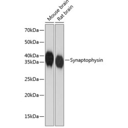 Synaptophysin Rabbit mAb
