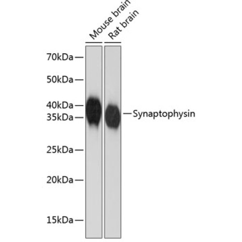 Synaptophysin Rabbit mAb