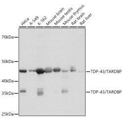 TDP-43/TARDBP Rabbit mAb