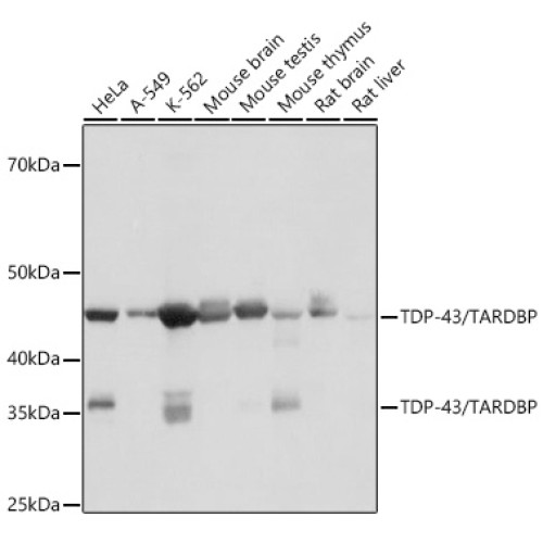 TDP-43/TARDBP Rabbit mAb