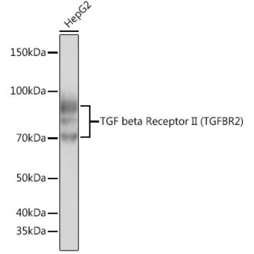 TGF beta Receptor II Rabbit mAb