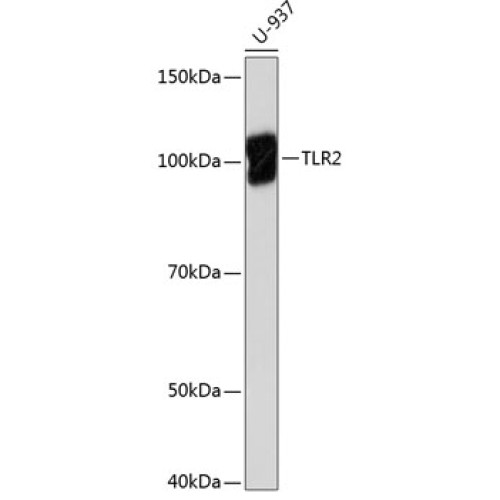 TLR2 Rabbit mAb