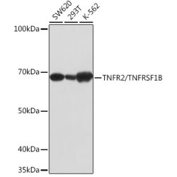 TNFR2/TNFRSF1B Rabbit mAb