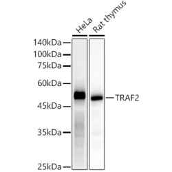 [KD Validated] TRAF2 Rabbit mAb