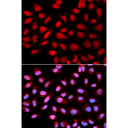 Ser/thr-PP2A activator (PTPA) Rabbit pAb