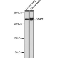 VEGFR1 Rabbit mAb