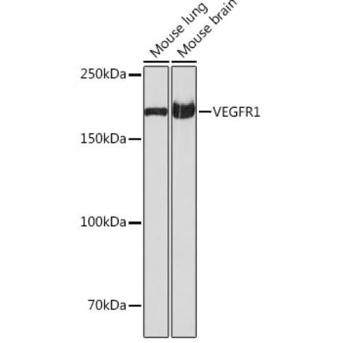 VEGFR1 Rabbit mAb