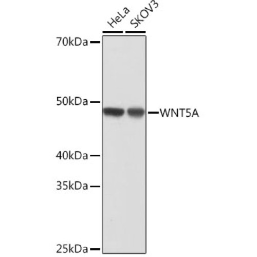 WNT5A Rabbit mAb