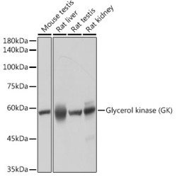 Glycerol kinase (GK) Rabbit mAb