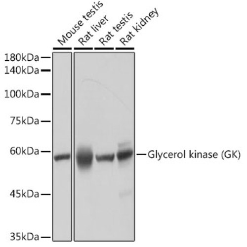 Glycerol kinase (GK) Rabbit mAb