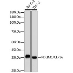 PDLIM1/CLP36 Rabbit mAb