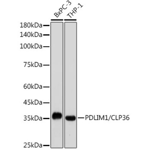 PDLIM1/CLP36 Rabbit mAb