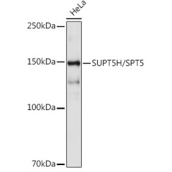 SUPT5H/SPT5 Rabbit mAb