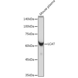 LCAT Rabbit mAb