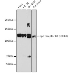 Eph receptor B3 (EPHB3) Rabbit mAb