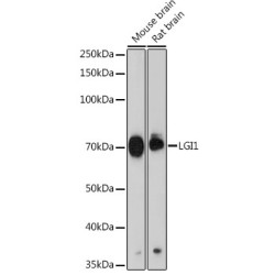 LGI1 Rabbit mAb
