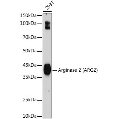 Arginase 2 (ARG2) Rabbit mAb