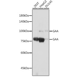 GAA Rabbit mAb