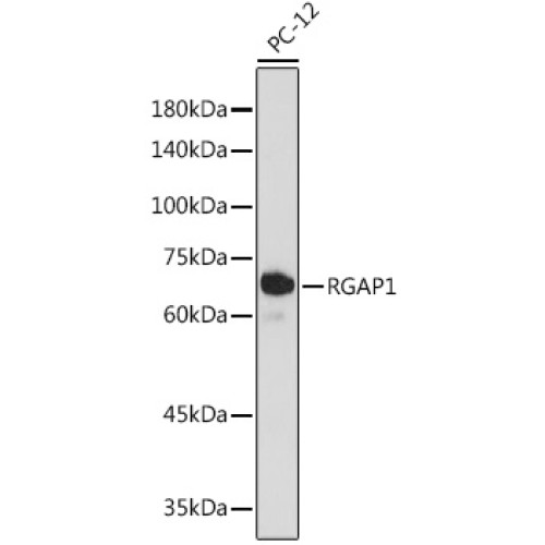 RGAP1 Rabbit mAb