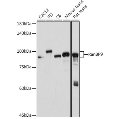 RanBP9 Rabbit mAb