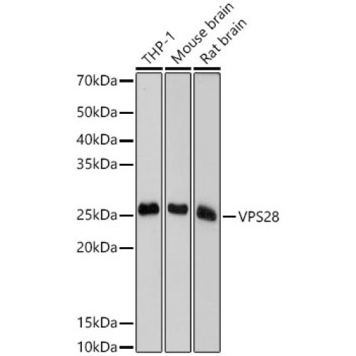 VPS28 Rabbit mAb