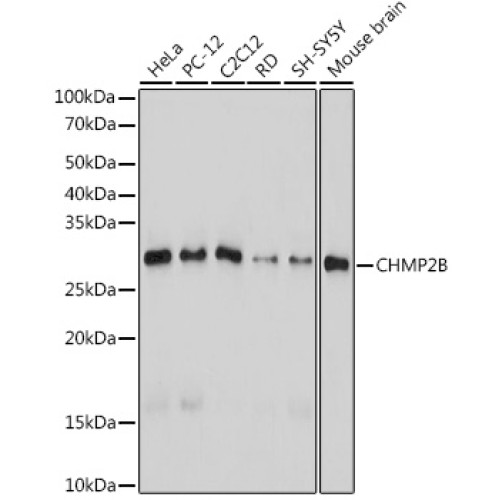 CHMP2B Rabbit mAb